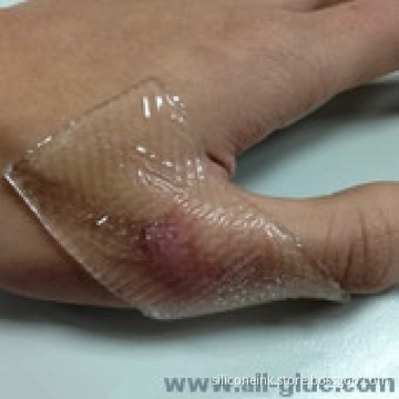 Silicone adhesive liquid clear adhesive for Silicone gel scar sheet